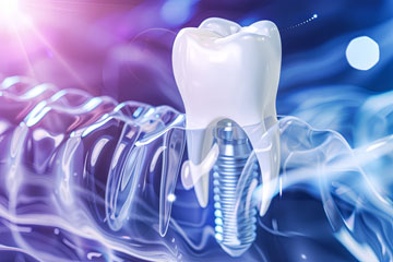 Zahnimplantate, Zahnverlust - leistungsstarke Zahnversicherung - Selle Versicherungen Mannheim